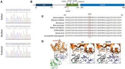 Case report: Identification of a novel variant p.Gly215Arg in the CHN1 gene causing Moebius syndrome